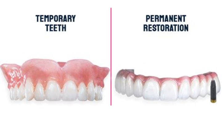 What is a permanent restoration