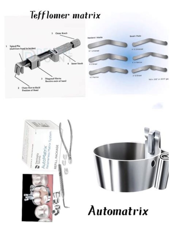 What is a tofflemire used for