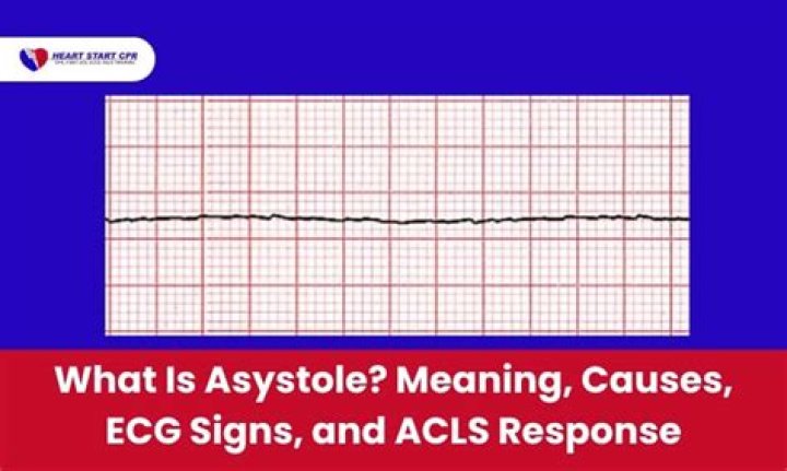 What is asystole protocol