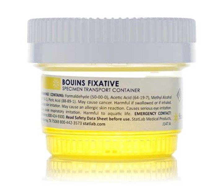 What is Bouins fixative used for