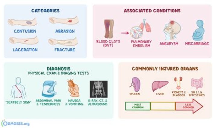 What is considered blunt force trauma