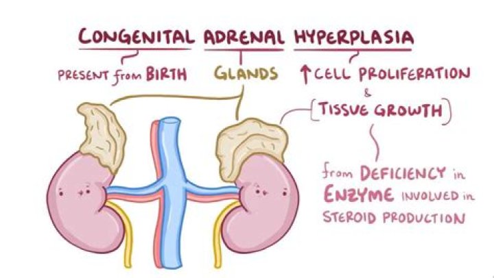 What is Nonclassic congenital adrenal hyperplasia