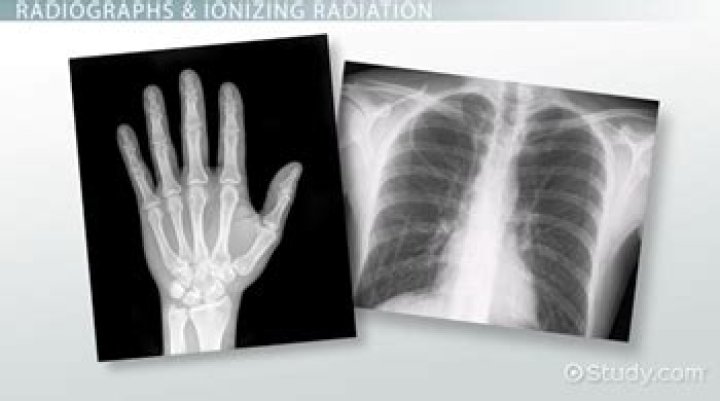 What is radiology in simple words