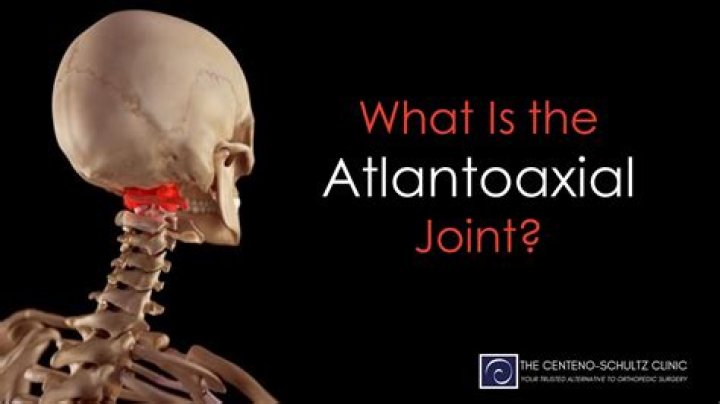 What is the atlantoaxial joint