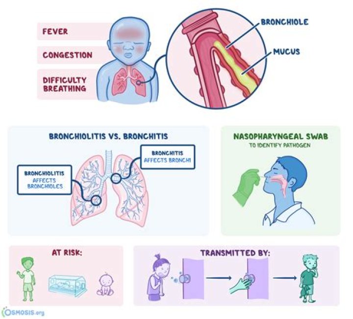 What is the difference between RSV and bronchiolitis