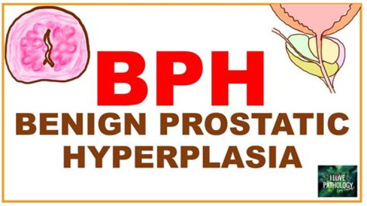 What is the main cause of BPH