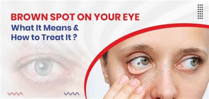 What is the meaning of brown spot
