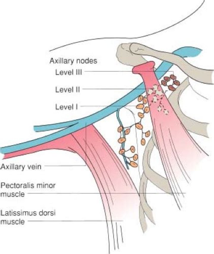 What is the normal size of a axillary lymph node