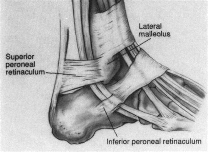 What is the peroneal Retinaculum