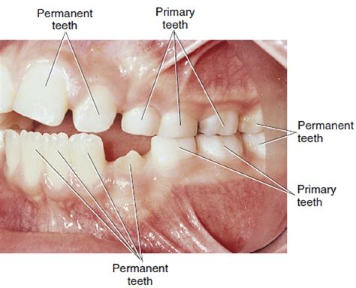 What is the primary dentition