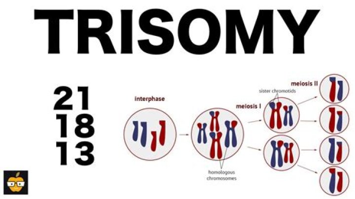 What is trisomy give two examples