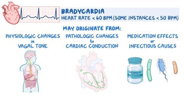 What potassium causes bradycardia