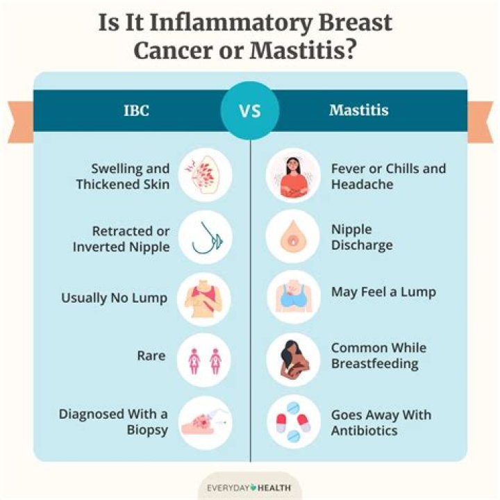 What were your first IBC symptoms