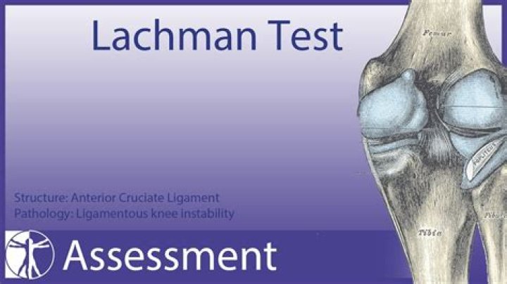 When is the Lachman test positive