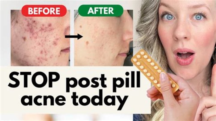 When should I stop taking Epclusa