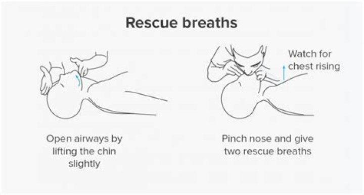 Why is rescue breathing important