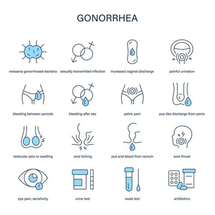 Will gonorrhea of the throat go away